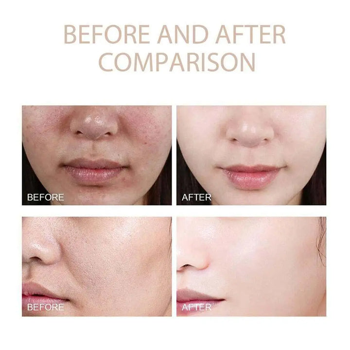 Radiant Rice Exfoliating Essence™ – Reveal Your Natural Glow
